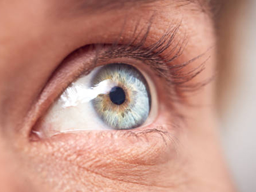 Pigmentierte Ringe auf der Iris - tellmeGen™